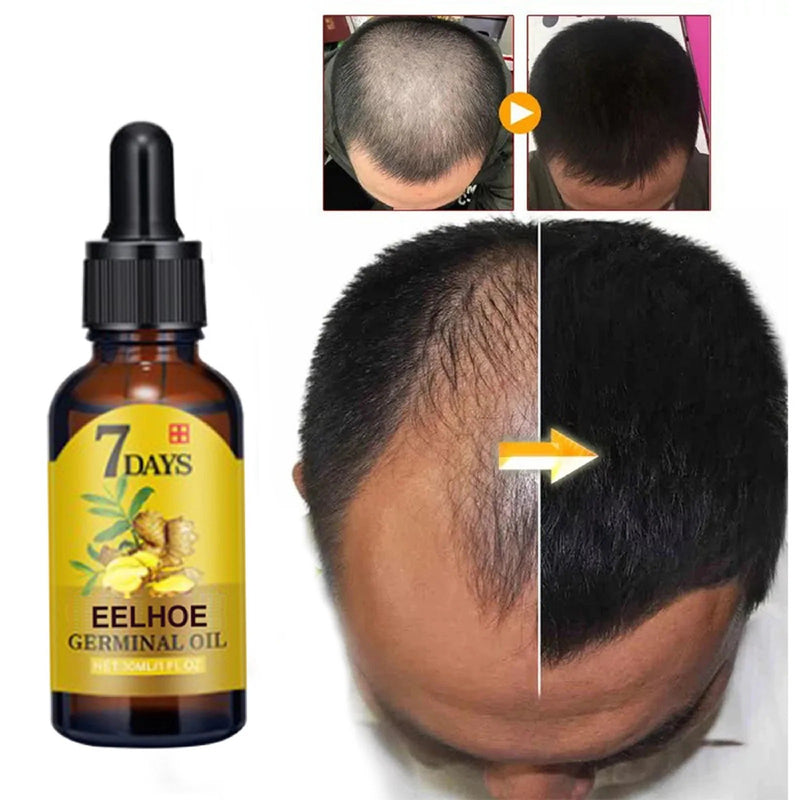 Sérum Profissional de Crescimento e Fortalecimento Capilar - Óleo de Gengibre Prime | Dom Conrado